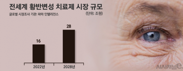 글로벌 황반변성치료제 시장 규모./ 그래프=정승아 디자이너