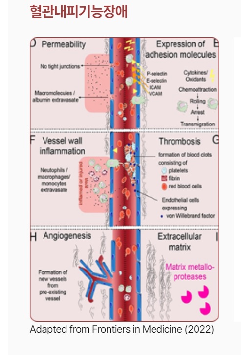 밀착 연접이 손상돼 혈관 투과성이 증가하고, 백혈구가 유출돼 혈관벽 염증상태가 유발된 모습. 염증으로 인해 혈전이 생성되고, 기존 혈관으로부터 새로운 혈관이 생성되는 병리적 상태 관련 그림./